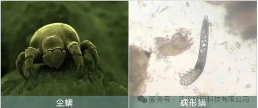 防螨！已成為健康的&ldquo;新剛需&rdquo;--武漢時間科技推出紡織品防螨整理劑喜化&reg;植螨零